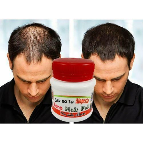 Zero Hair Fall