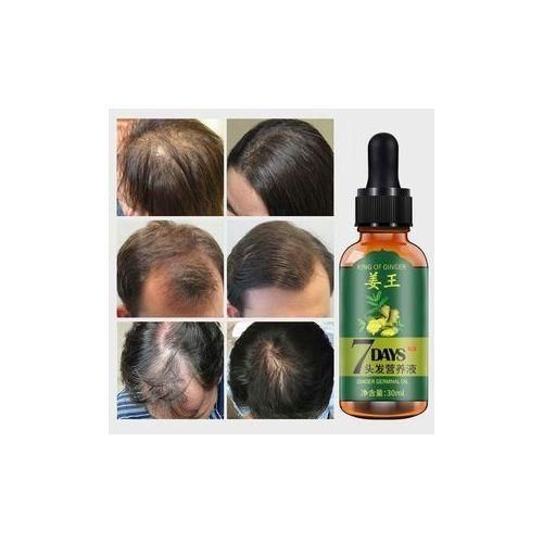 Aichun Beauty Hair Growth Serum For Men & Women- 7days Tonic Ginger Germinal Oil
