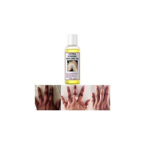 MOOYAM Extra Strong Peeling Oil Elbows Knees Hands Even Complexion