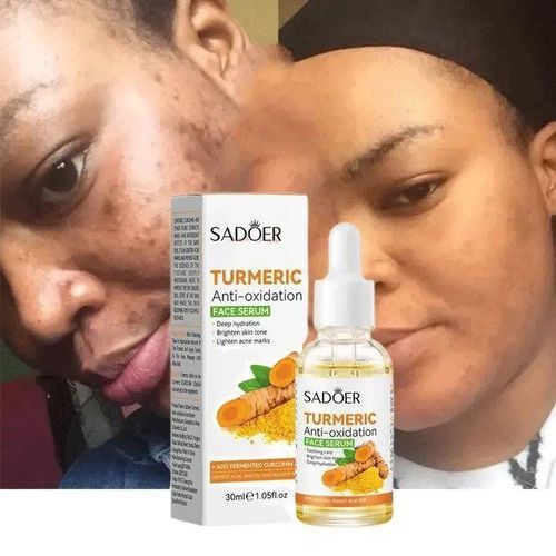 Dark Spots Remover Corrector Brightening Tumeric Toner Anti-Oxidatiion Face Serum