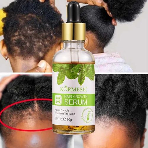 Hair Growth Serum Scalp Nourishing Hair Growth Oil For Women & Men Hair Growth Essence