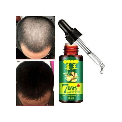 7 Day Hair & Beard Growth Ginger Germinal Oil