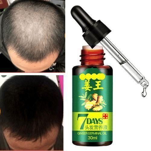 7 Day Hair Tonic Ginger Germinal Regrowth Oil