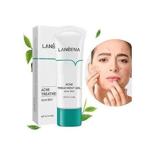 Acne Gel, Acne Treatment Gel