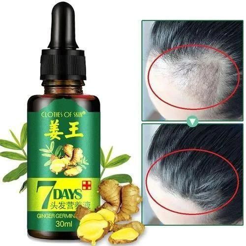 Quick Hair Growth Oil Ginger 7 Days Germinal Hair Oil Growth Essence