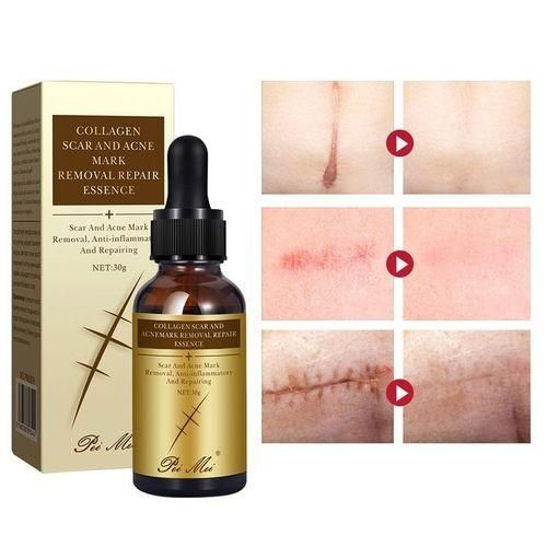 Creamy Pei Mei Collagen Scar & Acne Mark Removal Repair Essence - 30g