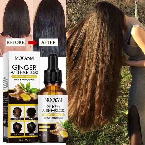 New Hair Growth Essence Ginger Hair Scalp Nourishing Serum 30ml Hair Growth Essential Oil