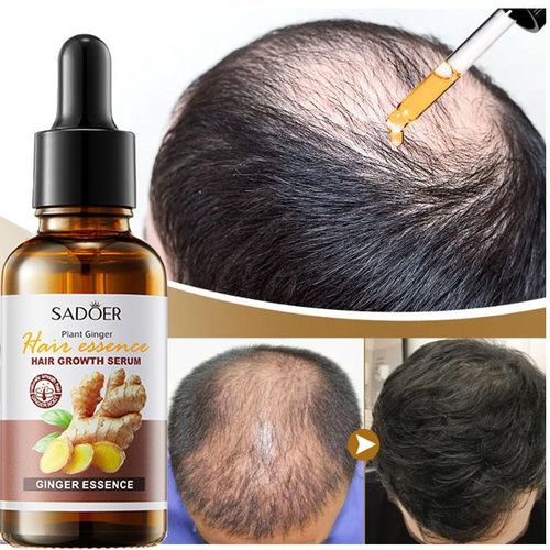 Hair Growth Oil Serum Ginger Essence Fast Hair Growth Activator Anti Hair Loss Products Hair Booster