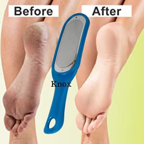 File Foot Scrubber Callous Remover
