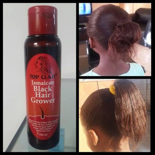Top Class Jamaican Hair Grower β Intensive Hair Care Treatment, 150ml
