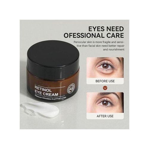 IREV Retinol eye cream Reduce Wrinkles and Fine lines
