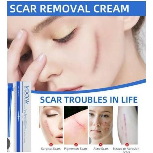 MOOYAM SCAR REMOVAL CREAM