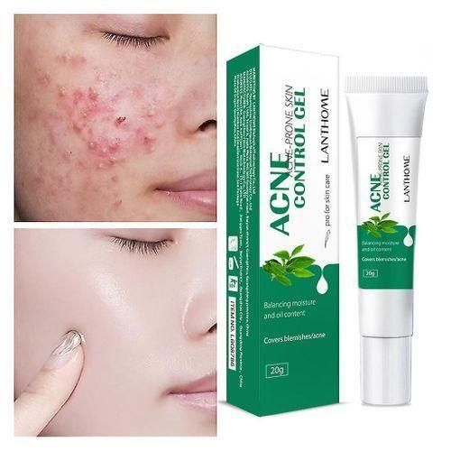 Lanthome Acne Control Gel - Remove Acne, Shrink Pores, Covers Blemish/Acne