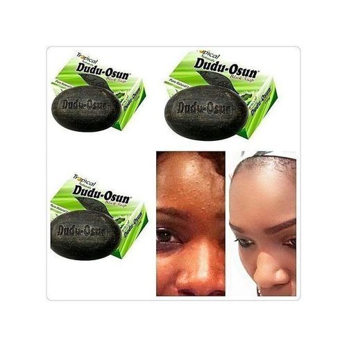 Dudu-Osun Black Soap - 150 Grams-3pcs