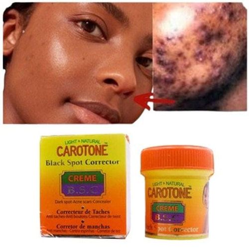 Carotone Light And Natural Black Spot Corrector Acne Scars Concealer - 30mL