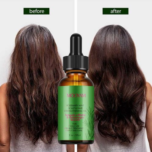 Rosemary Mint Hair Strengthening & Scalp Oil With Biotin, Rosemary Mint Nourishing Treatment For Split Ends, Hair Growth & Dry Scalp Care_59ML
