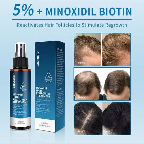 Carvenchy Minoxidil Hair Regrowth Treatment 5% Spray 100ml Advanced Hair Growth Solution That Strengthens Roots Reduces Hair Loss And Promotes Thicker Fuller Hair
