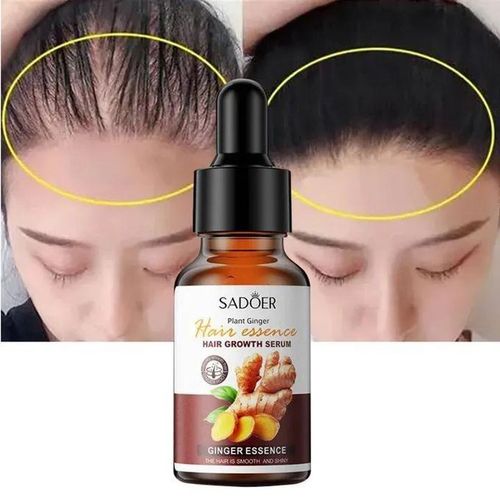 Hair Growth Oil Serum Ginger Fast Hair Growth Activator Anti Hair Loss Products Hair Booster - 3OML
