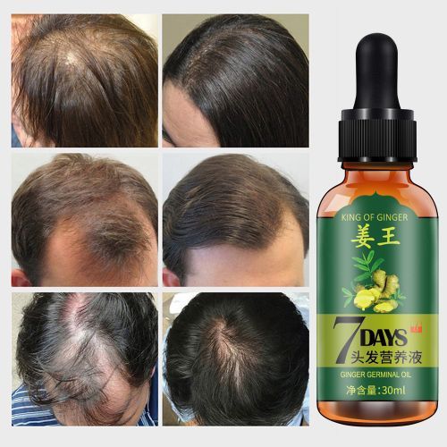 Aichun Beauty 7 Days King Of Ginger Germinal Hair Oil Growth Essence- 30ml