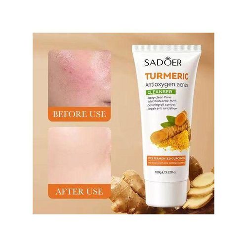 SADOER Turmeric Cleanser Anti Acnes Facial Cleanser