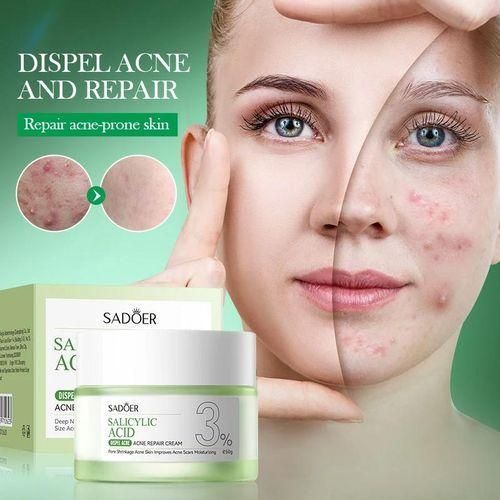 SADOER Salicylic Acid Repair Cream,Salicylic Acid Face Moisturizer,Pore Shrinkage Acne Skin Improves Acine Scars Motsturizing,Suitable for Oily, Acne Prone Skin