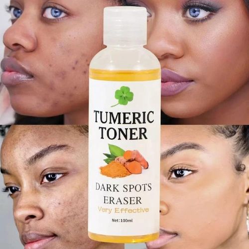 Quick Dark Spots Corrector Serum Tumeric Toner Acne Remover Fade Dark Spots Eraser Skin Care Serum-100ML
