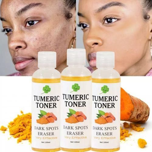 Dark Spots Corrector Tumeric Toner Pimples Remover Acne Remover