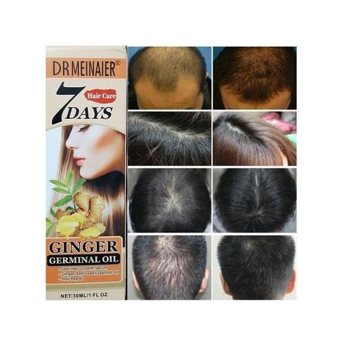 DR MEINAIER Ginger Germinal Hair/Beard Growth Repair Oil -30ml
