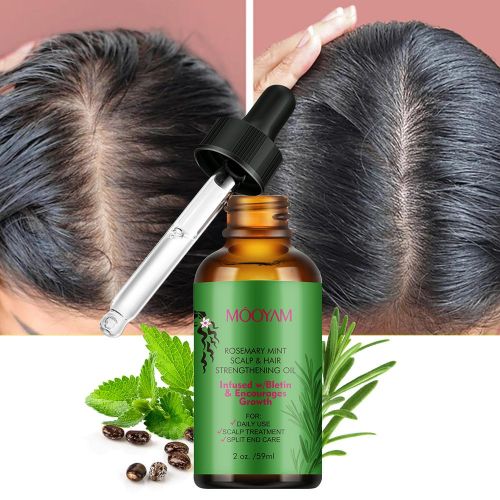 Rosemary Mint Scalp & Hair Strengthening Oil With Biotin And Essential Oils, Rosemary Mint Nourishing Treatment For Split Ends, Hair Growth & Dry Scalp
