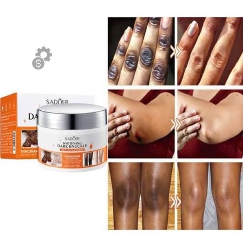 SADOER ntensive Knuckle Whitening Cream to Fade Dark Spots and Improve Skin Texture