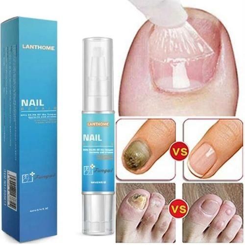 Lanthome Nail Repair Nail Treatment Fungus Removal Fungal Nail Restoration Onychomycosis Serum Pen