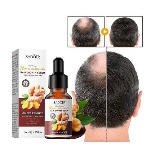 Fast Hair Growth Serum, Ginger Hair Regrowth Serum, Activator Oil Nourishing Scalp Treatment