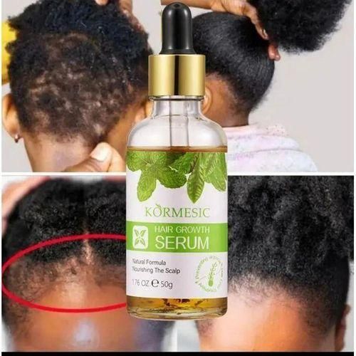 KORMESIC Hair Growth Serum