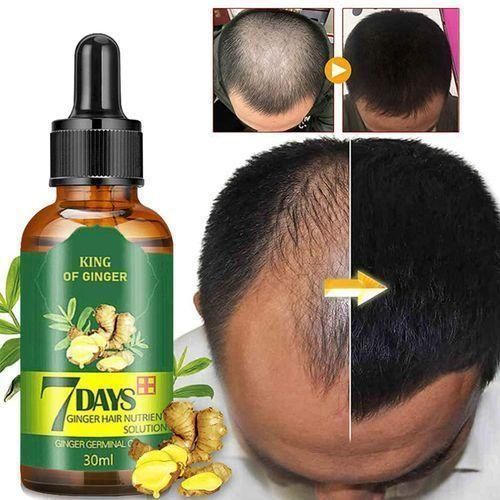 Clothes Of Skin Hair Tonic & Beard Growth Anti-hair Loss Ginger Oil minoxidil