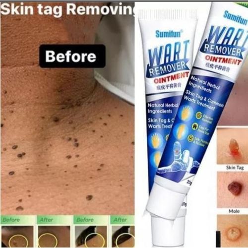 Sumifun Warts Removal Ointment Cream