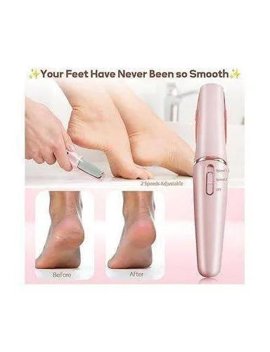 New electric callous remover